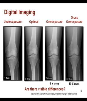 Digital imaging is the best with respect to radiation safety.